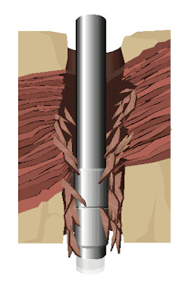  Wellbore Instability 